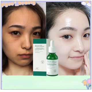 Serum trắng da Serum se khít lỗ chân lông 30ML Se khít lỗ chân lông lột mụn đầu đen vết mụn dưỡng ẩm HB