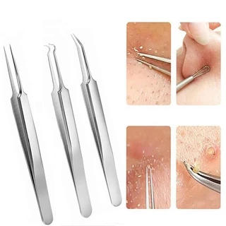 Set 3 Nhíp Lấy Mụn Đầu Đen / Mụn Trứng Cá / Đầu Nhọn Tiện Lợi