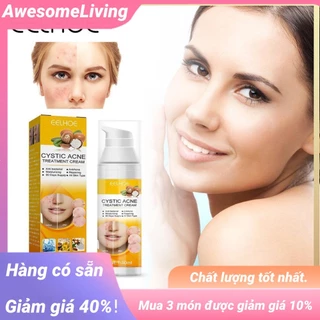 Kem Hỗ trợ giảm mụn Cystic 30ml Giúp Dưỡng Ẩm Và Làm Trắng Da Hiệu Quả