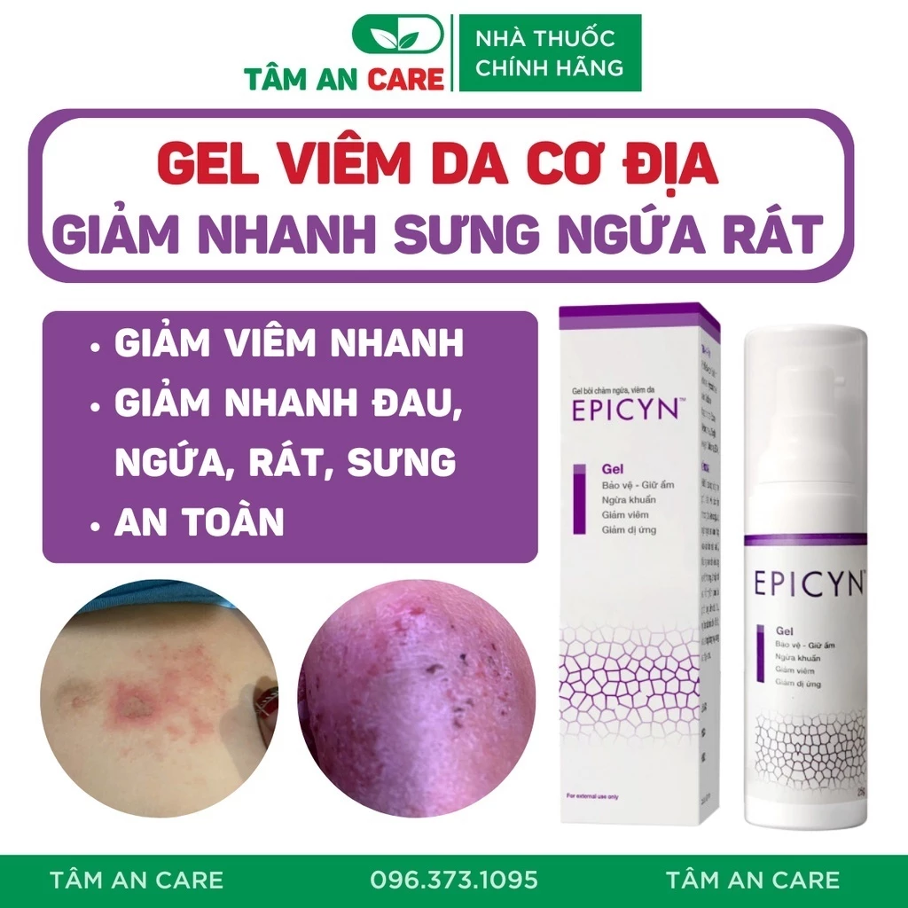 Gel Viêm Da Cơ Địa, Chàm Ngứa, Vảy Nến, Viêm Da Dị Ứng, Giảm Nhanh Đau, Ngứa, Rát, Sưng, Tiết Dịch, Gel Epicyn 25g