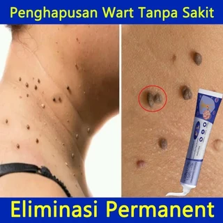 South Moon Wart Removal Cream Kem tẩy nốt ruồi mụn cóc mụn thịt mụn cơm mụn ruồi