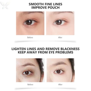 Kem dưỡng mắt chống nhăn mới Fades Fine Lines Chống quầng thâm Serum mắt Loại bỏ túi mắt bọng mắt Chống lão hóa Chăm sóc mắt