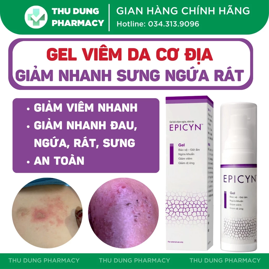 Gel viêm da cơ địa, chàm ngứa, vảy nến, viêm da dị ứng, giảm nhanh đau, ngứa, rát, sưng, tiết dịch, Gel Epicyn 25g