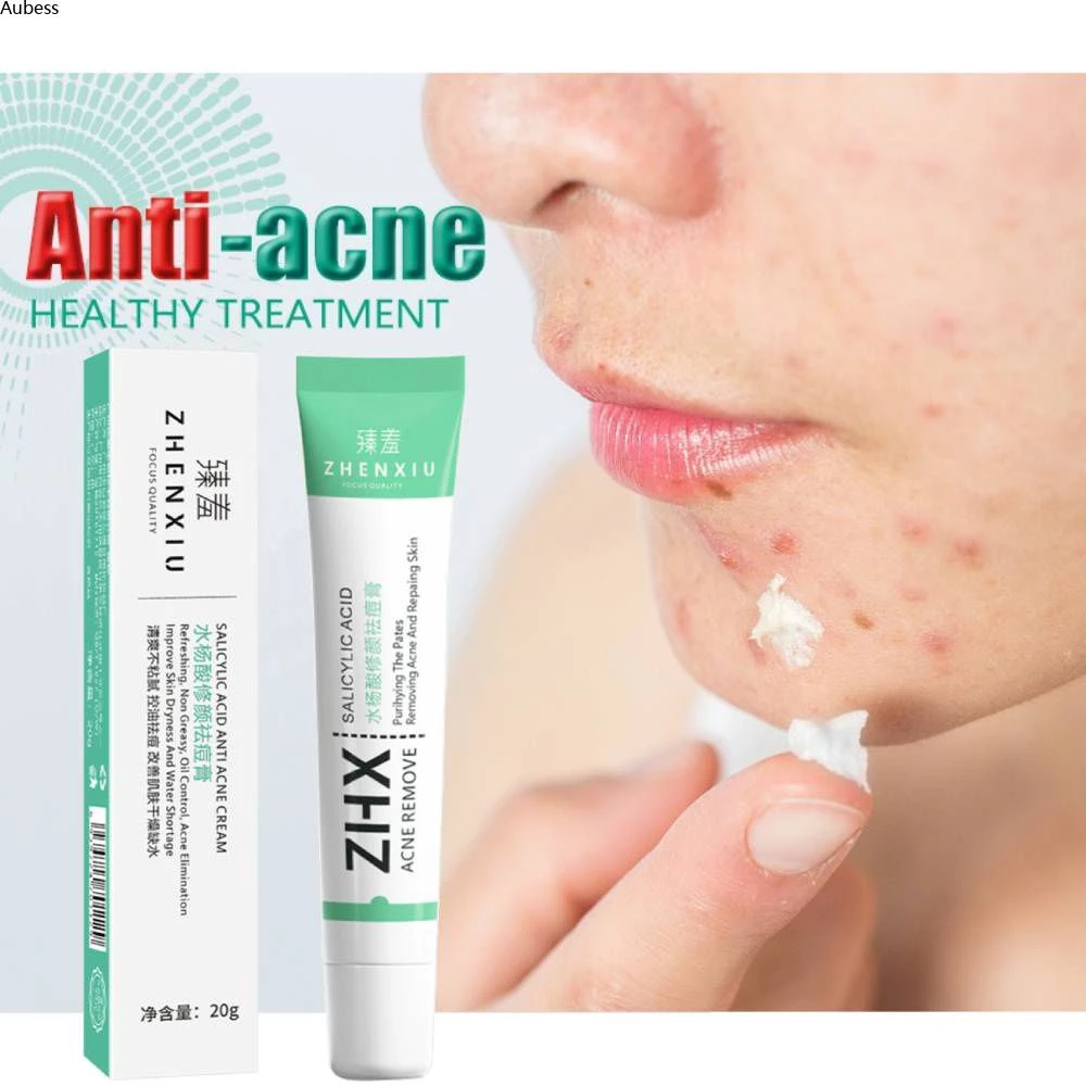 1/2 Chiếc Axit Salicylic Điều Trị Mụn Thâm Sẹo Tẩy Da Mặt Chăm Sóc Da Kem Trị Mụn Lỗ Chân Lông Kem AubessDS