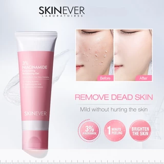 Skinever Niacinamide hồng Tẩy tế bào chết Gel làm trắng da mặt Tẩy tế bào chết toàn thân Loại bỏ mụn đầu đen 55ML