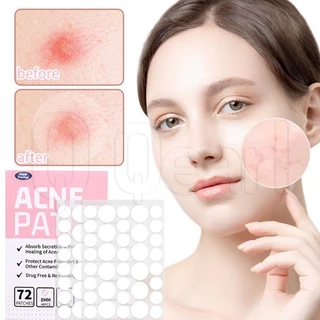 72 Miếng Dán Mụn Vô Hình - Loại Bỏ Mụn Miếng Dán - Miếng Dán Loại Bỏ Mụn Hydrogel - Để Chữa Bệnh Chăm Sóc Da Mặt - Thoáng Khí, Kháng Khuẩn - Miếng Dán Sửa Chữa Da Mặt