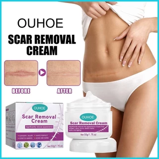 Sevich Burn Scar Cream Fades sẹo Phẫu thuật Loại bỏ sẹo Chăm sóc sẹo Mụn nhọt Alonmy Skin Repair Cream