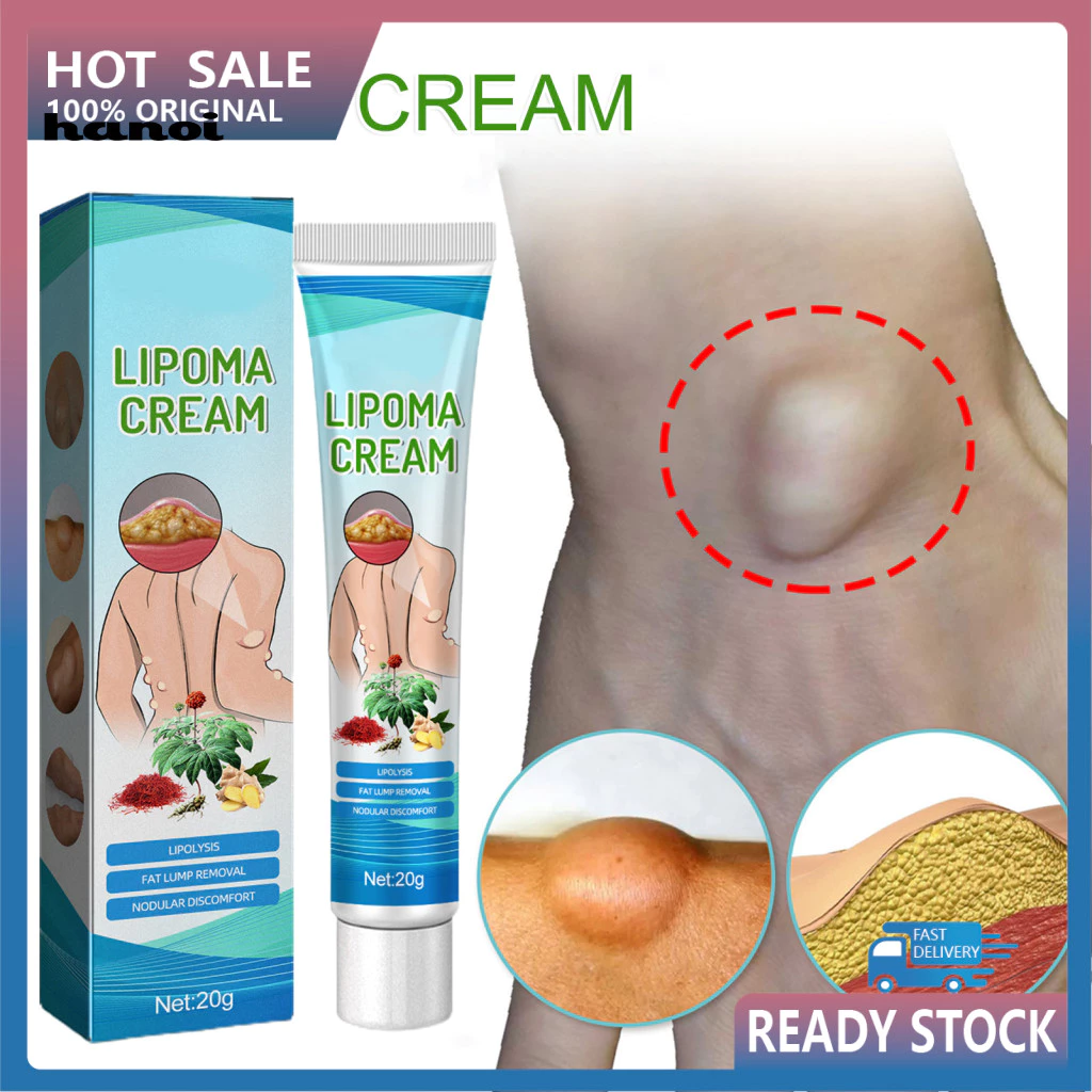 Han _ 20g Kem Lump Béo Không Đau Giải Quyết Thâm Nhập Liên Tục Giải Quyết Núm Vú Subcutaneous Free Lipoma Removal Cream cho Cơ Thể