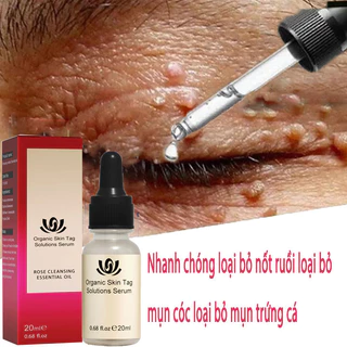 Serum Tẩy Nốt Ruồi Tẩy Nốt Ruồi, Mụn Cơm, Mụn Cóc, Mụn Thịt