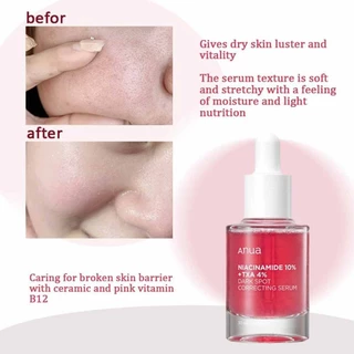 30ML Anua Dark Spot Correction Serum Brighter Complexion and Even Skin Tone Face Skin Care Tools	