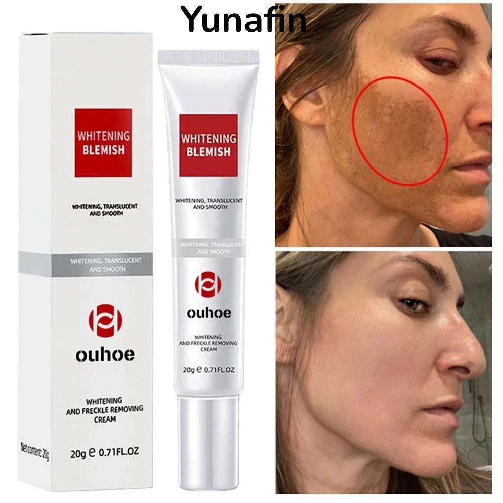 Yunafin Loại bỏ vết thâm, 20g Loại bỏ Kem Hỗ trợ giảm tàn nhang làm trắng da Melanin, Làm sáng da làm sáng da mặt hiệu quả Kem dưỡng da mặt