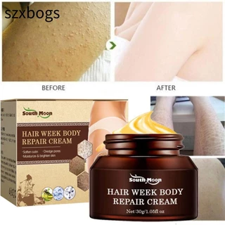 szxbogs Kem điều trị phục hồi Keratosis Pilaris, 30g Kem dưỡng ẩm sâu Loại bỏ da gà, Bán chạy Làm sạch vết thâm Dưỡng ẩm Chăm sóc da Loại bỏ vết lõm Kem nam