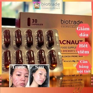 Viên Uống Biotrade Acnaut Supplement 30 viên Giảm Mụn Nội Tiết Kiềm Dầu Làm Đẹp Da