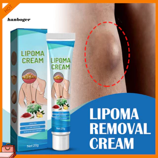 Han 20g Fatty Lump Cream Không đau Unblocking Sự thâm nhập liên tục Giải quyết các cục máu phụ Kem loại bỏ Lipoma không cần bơm cho cơ thể