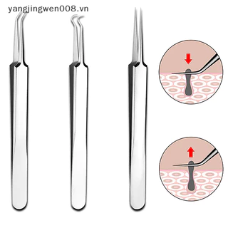 Yangwen 8CM Cell Pimples Kẹp mụn đầu đen Nhíp Thẩm mỹ viện Dụng cụ cạo đặc biệt Đóng hiện vật Hỗ trợ giảm mụn.