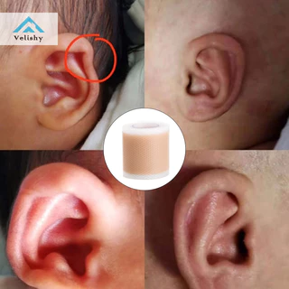 Miếng dán chỉnh tai em bé Velishy Băng silicon Miếng dán chỉnh sửa tai cho trẻ sơ sinh