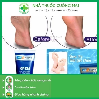 Kem nút gót chân Nga siêu nhạy hiệu quả sau 1 đêm