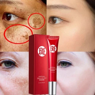 Kem tẩy tàn nhang Melasma Làm trắng vết thâm Loại bỏ vết thâm làm sáng da CAHNSAI 20g