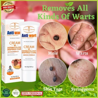 Mụn cóc Tẩy Kem Body Skin Tag Remover Thuốc mỡ kháng khuẩn rất hiệu quả