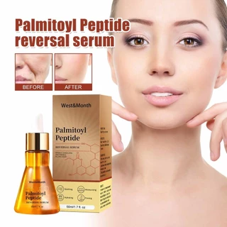 La * Palmitoyl Peptide Tinh chất chống lão hóa Làm sáng tông màu da Làm sáng da Dòng mịn Sửa chữa tàn nhang Serum Thu nhỏ lỗ chân lông Nâng cơ mặt Làm săn chắc Tinh chất chống nhăn Sản phẩm chăm sóc da