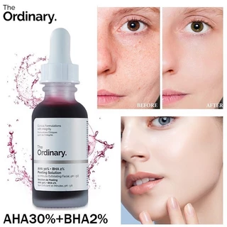 Tinh chất tẩy tế bào chết thông thường AHA 30%+BHA 2% Giải pháp lột da 30ml Da mịn