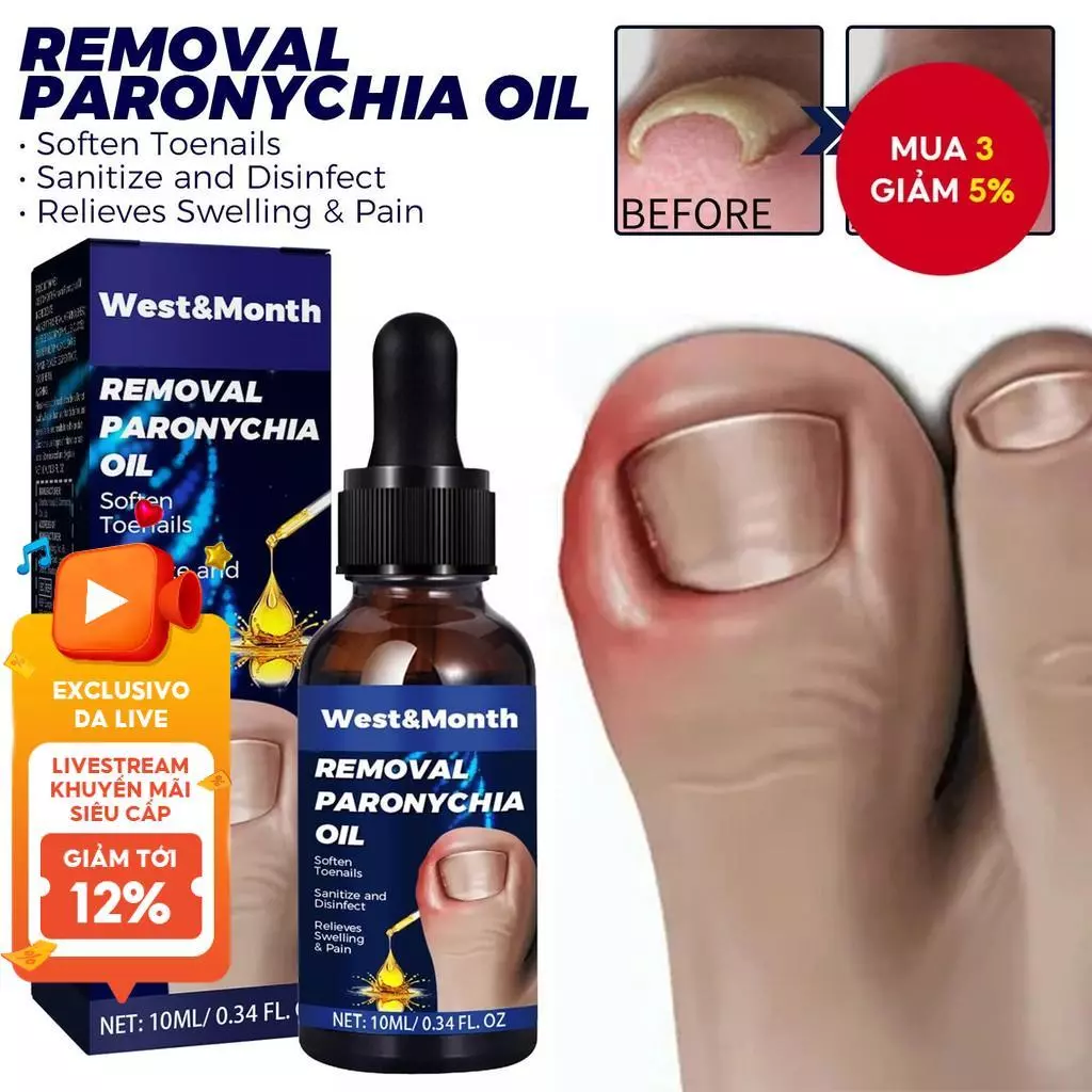 Loại Bỏ Dầu Paronychia Giảm Sưng Đau Putty Với Dầu Lỏng Móng Chân Sửa Móng Tay Làm Mềm Viền