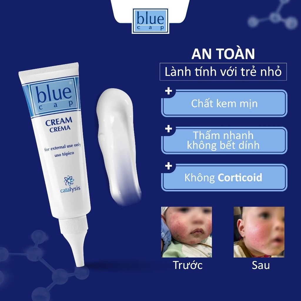 Blue Cap Cream - Kem Bôi Viêm Da Cơ Địa Cho Bé Giảm Ngứa, Mẩn Đỏ, Dịu Da, Tuýp 50g