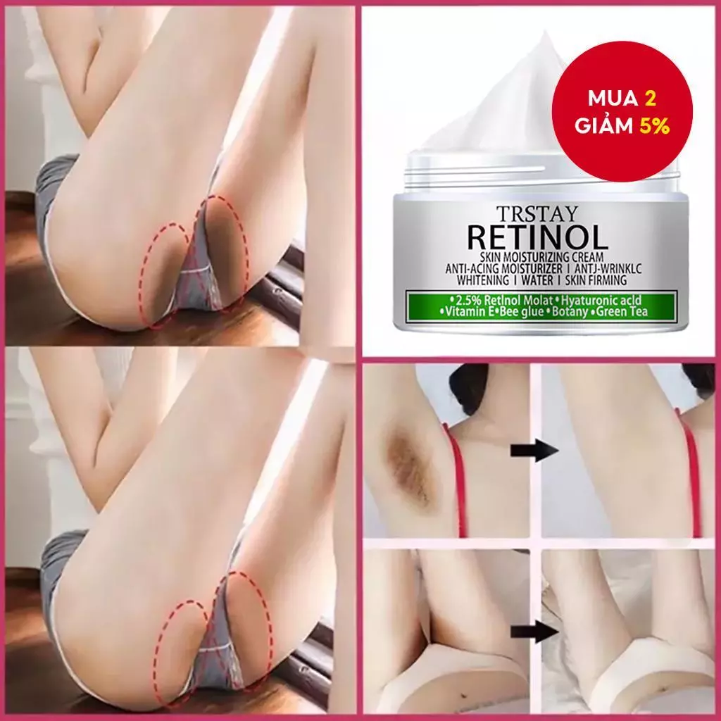 Kem làm trắng da thân mật, nách, đầu gối, đùi Serum phát sáng, loại bỏ Melanin - Kem làm trắng cơ thể thân mật, Nách, Đầu gối, Serum làm sáng da đùi, Loại bỏ Melanin