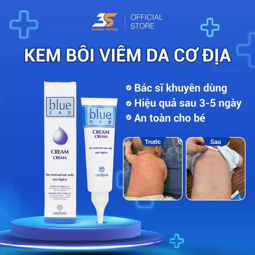 Blue Cap Cream - Kem Bôi Viêm Da Cơ Địa, Eczema, Chàm, Vảy Nến, Giảm Ngứa, Mẩn Đỏ, Dịu Da, Tuýp 50g