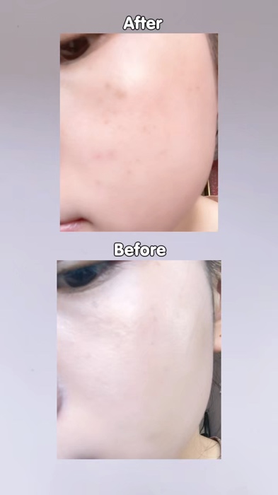 Kcn Torriden #KOC #skincare #KOL#skincare #xuhuong #SandealcungKOL #Sandealcungkol #HangMoiVe #makeup #torriden #kcn#duariviu