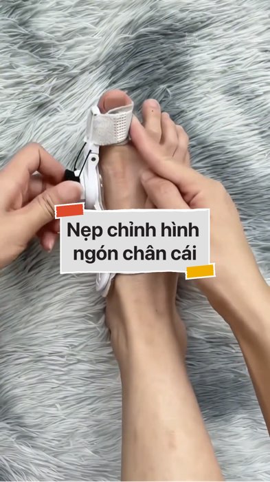 ￼Nẹp chỉnh hình ngón chân cái #VideohangDoiSong#ShopeeVideo#ShopeeCreator #LuotVuiMuaLien#KOLUyTin#Videomuasam #SandealcungKOL #diumi703