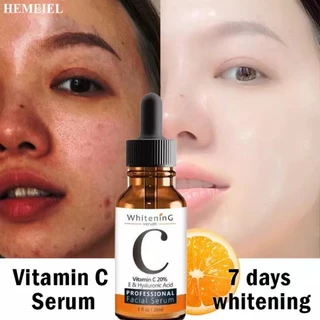 Serum Vitamin C Siêu Dưỡng Trắng, Hết Nhăn, Giảm Mụn, Trẻ Hóa Da, Giúp Da Đều Màu, Giảm Thâm Mắt, Chống Nám, Tàn Nhang