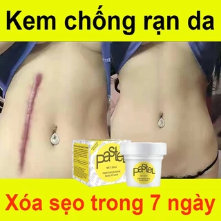 Kem Làm Mờ Rạn Da, Kem Tái Tạo Da Hiệu Quả Cho Bà Bầu Anti Stretch Marks Cream - Giảm Nhăn Do Tăng Cân Hiệu Quả