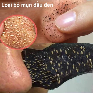 mặt nạ mụn đầu đen, gel mụn đầu đen, mặt nạ làm sạch, làm săn chắc da, làm trắng da