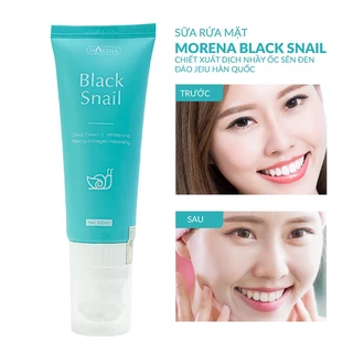 Sữa Rửa Mặt BLACK SNAIL Huyền Phi- Làm Sạch Sâu, Ngừa Mụn, Sáng Mịn Da.