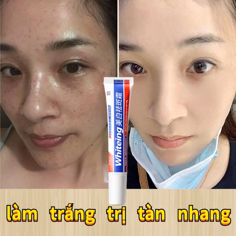 Kem nám tàn nhang và loại bỏ đốm Loại bỏ các đốm đen sâu làm sáng trắng da chống lão hóa nhanh chóng