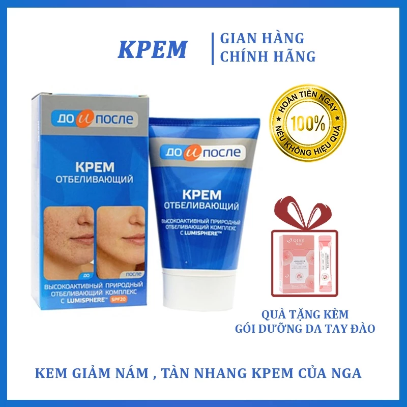 Kem Mờ Nám Kpem Nga 100ml - Xóa Đồi Mồi Thâm Nám Tàn Nhang Hiệu Quả