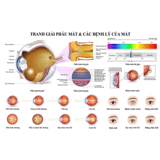 Tranh nhãn khoa,Tranh phòng kính,Tranh Decan dán bóng:Tranh giải phẫu mắt và các bệnh lý của mắt