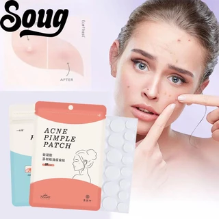 SOUG Set 36 Miếng Dán Hỗ trợ giảm mụn Vô Hình Tiện Dụng