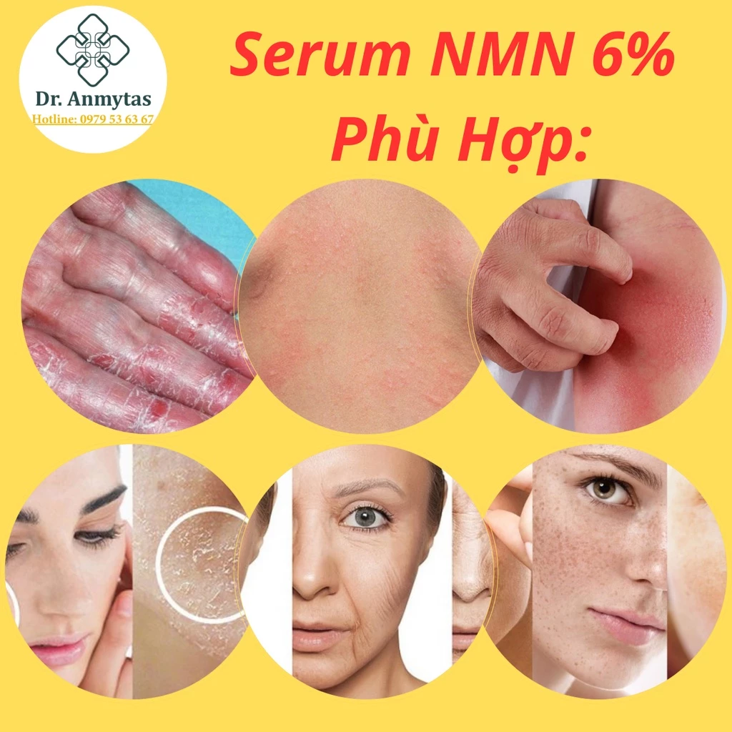 Serum Phục Hồi Nmn 6% Trẻ Hoá Da