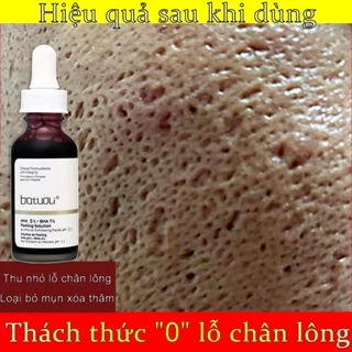 ⚡Chính Hãng⚡ Serum se khít lỗ chân lông trắng da 32ML Loại bỏ mụn đầu đen, se khít lỗ chân lông, làm trắng da mặt