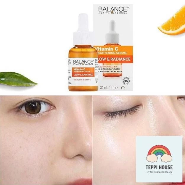 Serum Trắng Da, Mờ Thâm Balance Active Formula Vitamin C Brightening 30ml