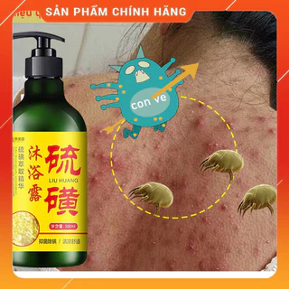 (Thảo dược 100% an toàn cho trẻ) Sữa tắm mụn lưng Sữa tắm lưu huỳnh sữa tắm trắng 500ml Loại bỏ mụn trứng cá và ve ngứa