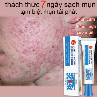 Kem thâm mụn Kem dưỡng da mụn Gel mụn dịu nhẹ sửa chữa xóa mụn Làm mờ vết thâm Thu nhỏ lỗ chân lông thô to