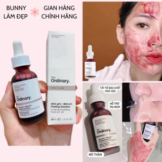 Serum Peel da AHA 30%+BHA 2% The Ordinary Tinh chất tẩy da chết không bong tróc 30ml HOT New