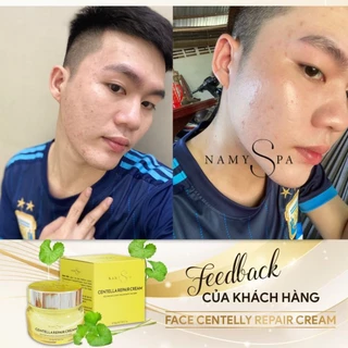 Kem face tri mụn Rau má - Namy Spa - giảm mụn,  mờ thâm, trắng da