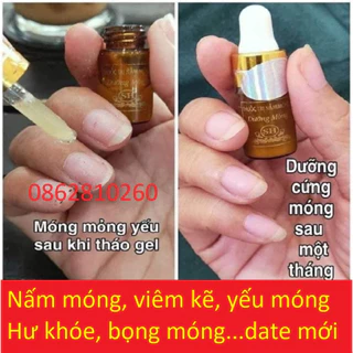 Serum SH đánh bay nấm móng, hư khoé, bọng móng, nước ăn tay chân viem móng gia truyền