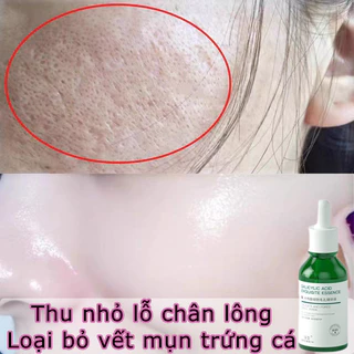 [Mua 2 tặng 1]Serum Thu Nhỏ Lỗ Chân Lông 30ml Serum trắng da Giúp Cân Bằng Bã Nhờn Làm Sáng Da Thu Nhỏ Lỗ Chân Lông