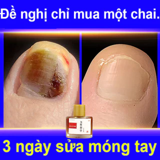 Tinh chất phục hồi diệt nấm móng phục hồi, giải quyết vấn đề viêm mé móng chân tay, hiệu quả nhanh dùng cho nam và nữ