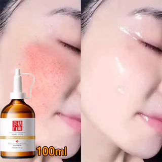 Tinh chất làm trắng sạch tàn nhang 100ml Kem trắng da và xóa tàn nhang, Hiệu quả làm mờ thâm nám tàn nhan, kem thâm nám